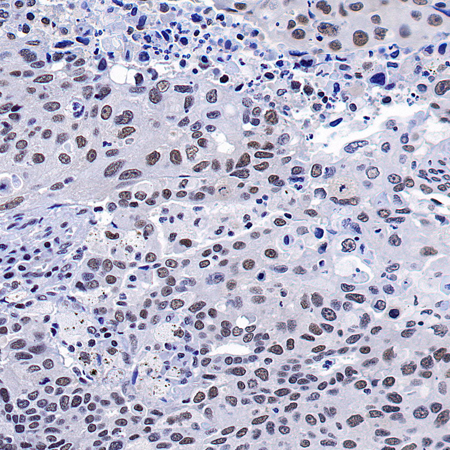 OGT Mouse mAb