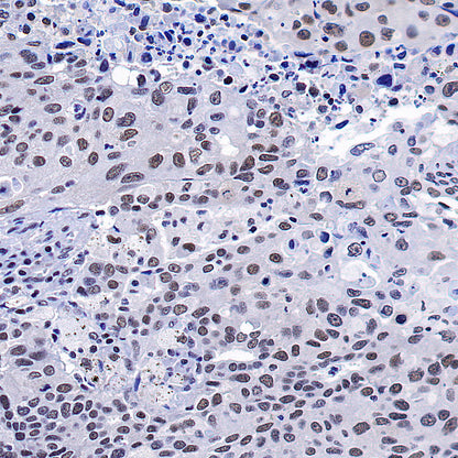 OGT Mouse mAb