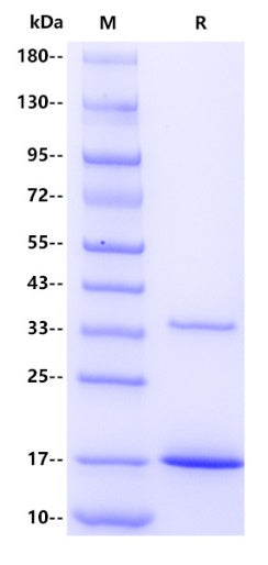 Human Transthyretin Protein, His Tag