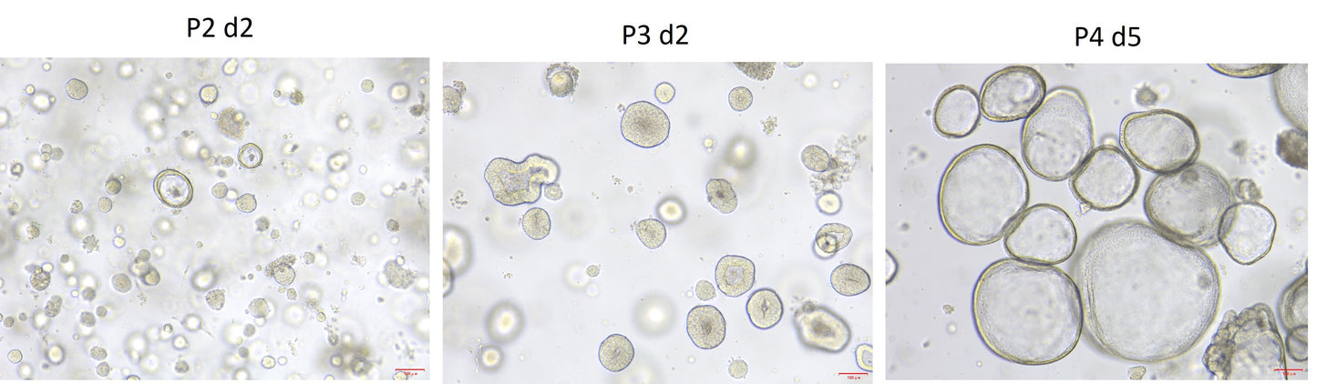 KGF/FGF-7 Protein, Human