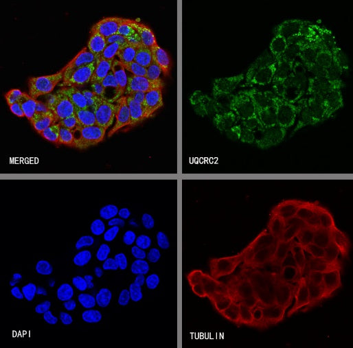 UQCRC2 Recombinant Rabbit mAb (S-2374-127)