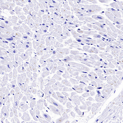 PTK7 Recombinant Rabbit mAb ,PBS Only(SDT-2432-156)