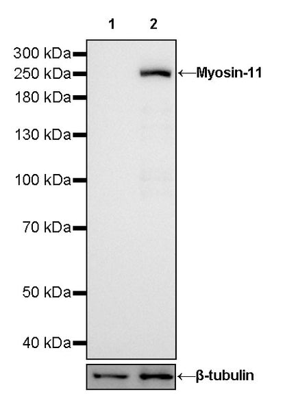 Myosin-11/SMMHC Recombinant Rabbit mAb,PBS Only (SDT-188-112)
