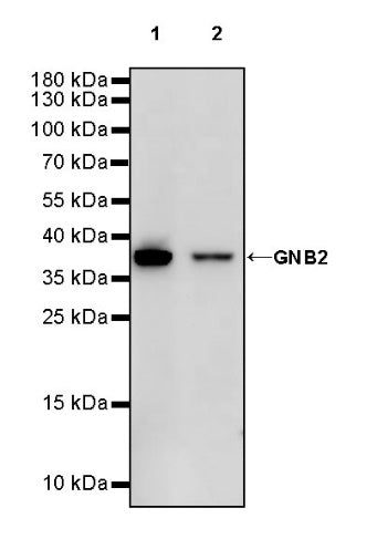 GNB2 Recombinant Rabbit mAb (S-645-10)