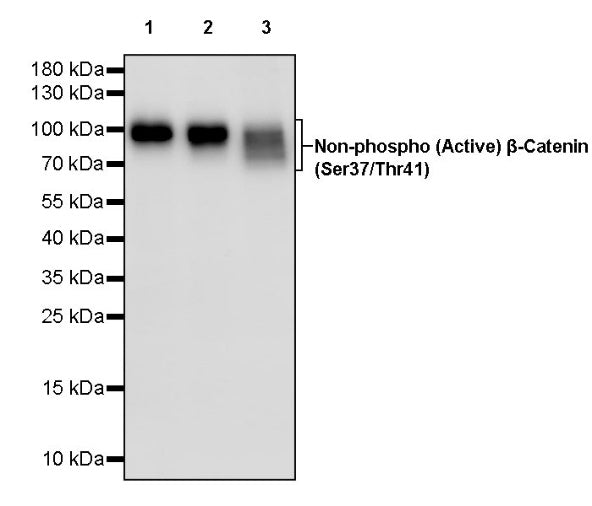 Non-phospho (Active) β-Catenin (Ser37/Thr41) Recombinant Rabbit mAb (S-1813-42)