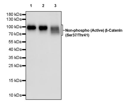 Non-phospho (Active) β-Catenin (Ser37/Thr41) Recombinant Rabbit mAb (S-1813-42)