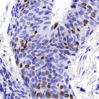 Ki67 Mouse mAb (SDT-606-33)