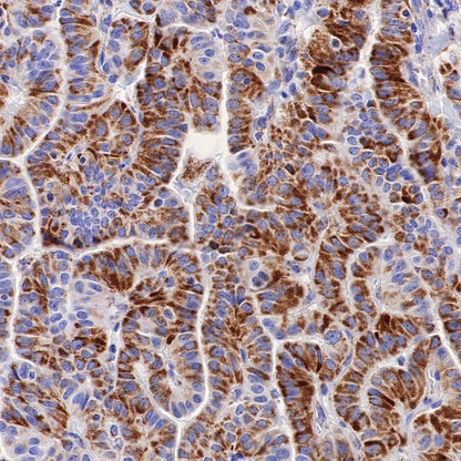 PTP1B Recombinant Rabbit mAb (S-R336)