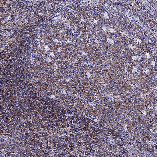 NF-κB p65 Recombinant Rabbit mAb (S-475-56)