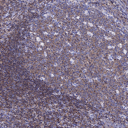 NF-κB p65 Recombinant Rabbit mAb (S-475-56)