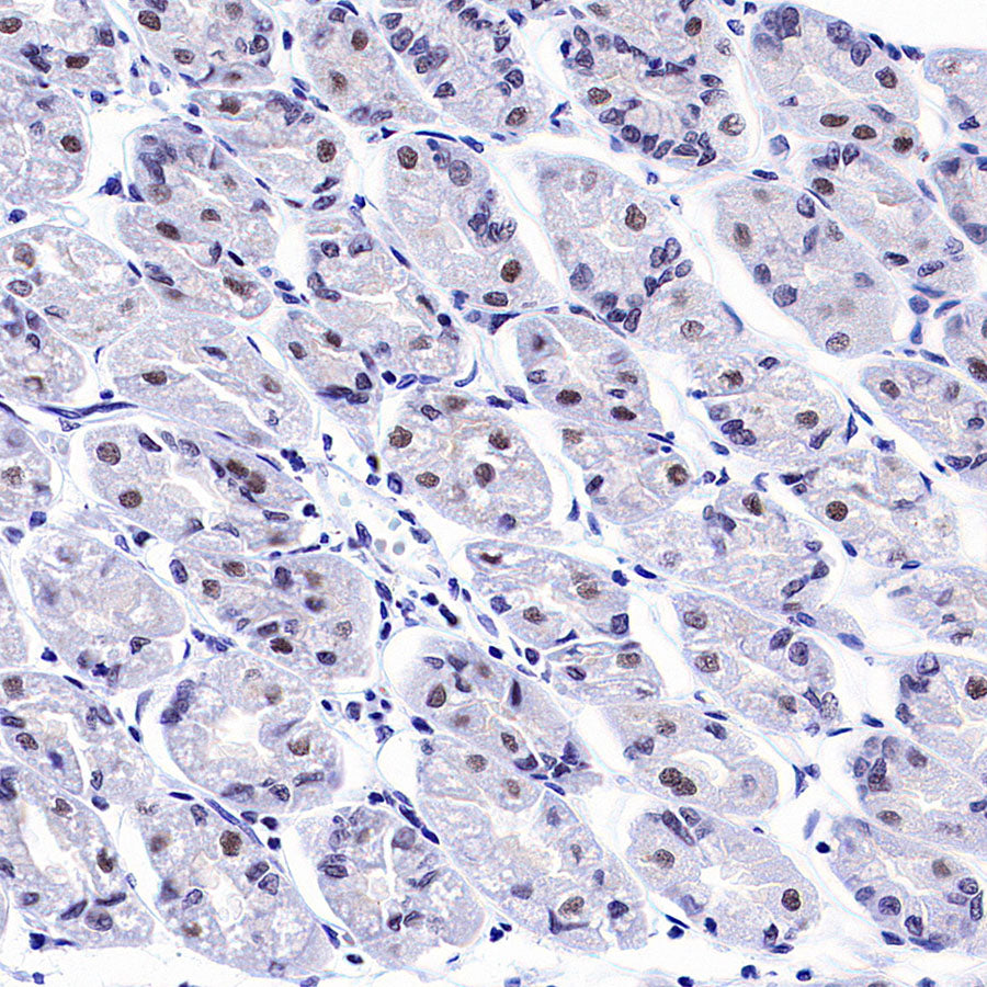 INI-1/SMARCB1 Recombinant Rabbit mAb (S-4068-21)