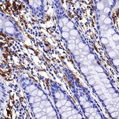 HLA-DRA Rabbit Polyclonal Antibody