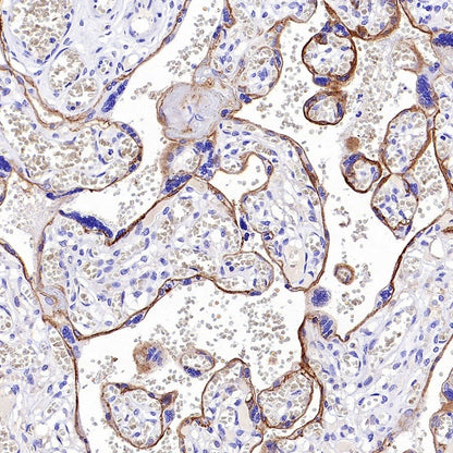 SLC40A1/Ferroportin Recombinant Rabbit mAb (S-2172-35)