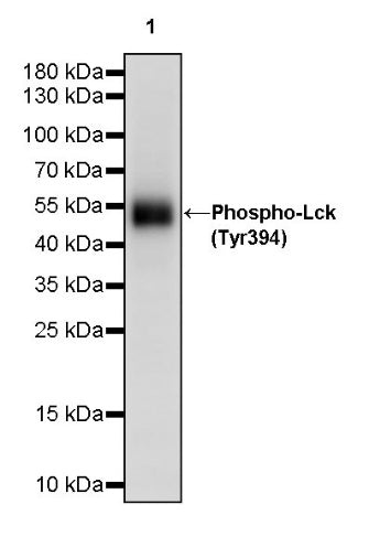 Phospho-Lck (Tyr394) Recombinant Rabbit mAb (S-1957-74)