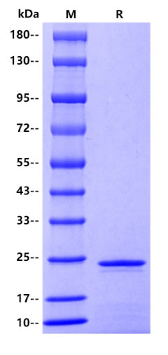 ferritin/FTH1 His Tag Protein, Human