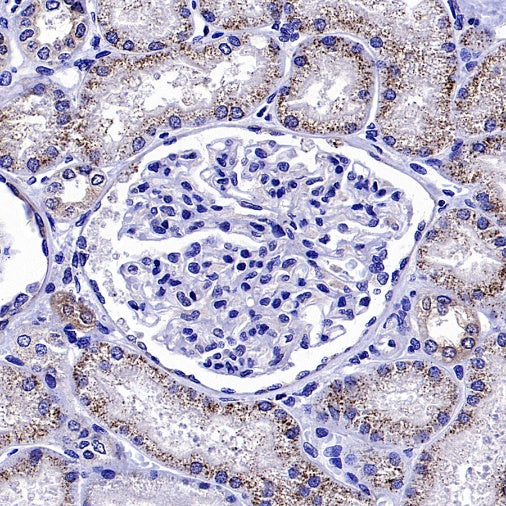 Optineurin Recombinant Rabbit mAb (S-2030-40)