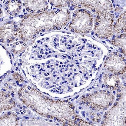 Optineurin Recombinant Rabbit mAb (S-2030-40)
