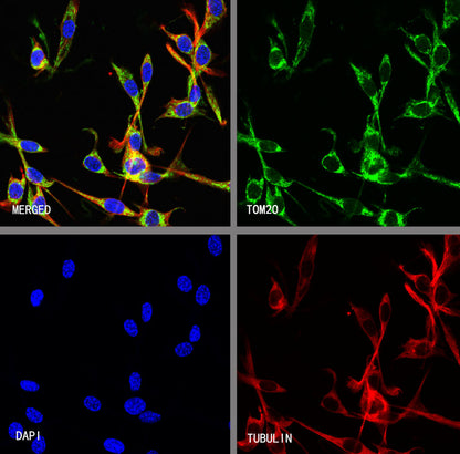 TOM20 Recombinant Rabbit mAb (S-M0015)