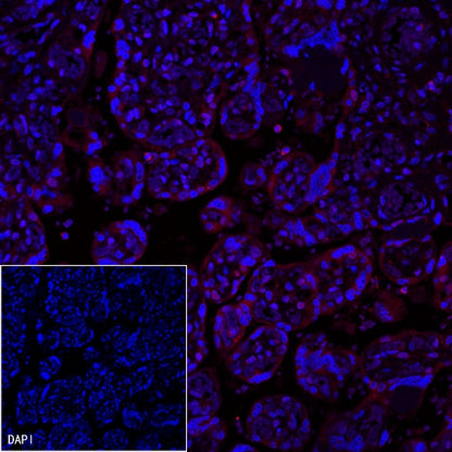 PD-L1 Recombinant Rabbit mAb (Alexa Fluor® 555 Conjugate) (SDT-119-16)