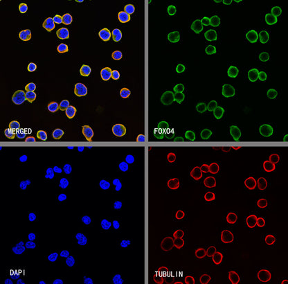 FOXO4 Recombinant Rabbit mAb (S-3527-19)