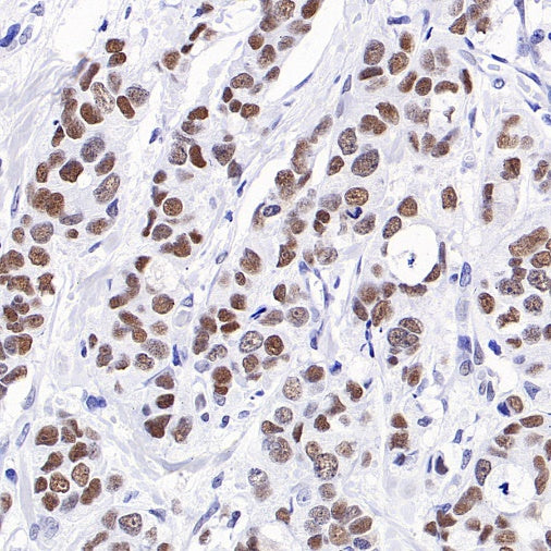 KDM1/LSD1 Recombinant Rabbit mAb (S-1280-80)