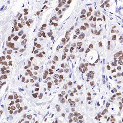 KDM1/LSD1 Recombinant Rabbit mAb (S-1280-80)