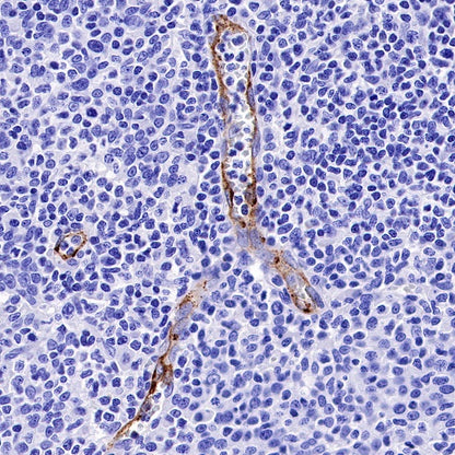 E-selectin Recombinant Rabbit mAb (S-1260-26)