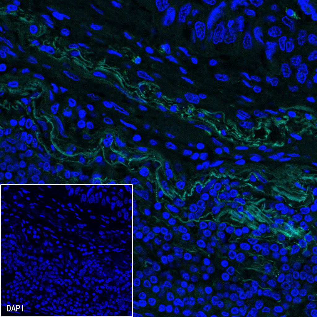 PDGFRA+PDGFRB Recombinant Rabbit mAb (S-393-11)