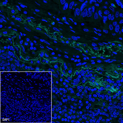 PDGFRA+PDGFRB Recombinant Rabbit mAb (S-393-11)