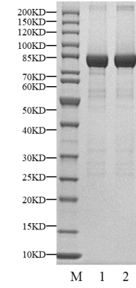 CHEK2(CHK2) GST Tag Protein, Human