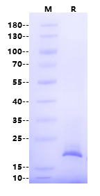 Claudin-4 His Tag Full Length Protein, Human (Detergent)