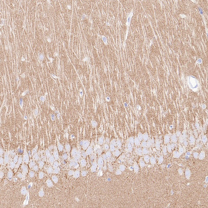 SV2A Recombinant Rabbit mAb (S-2096-2)
