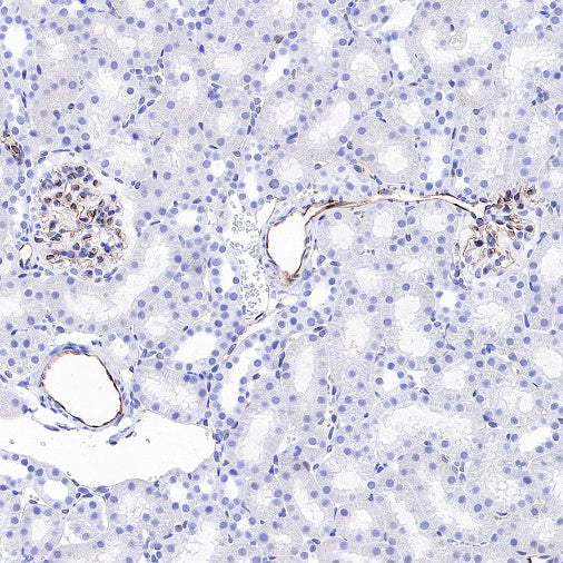 eNOS Recombinant Rabbit mAb (S-1885-94)