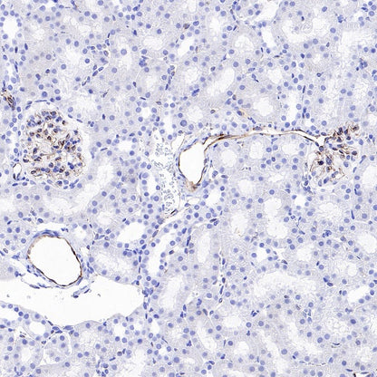 eNOS Recombinant Rabbit mAb (S-1885-94)