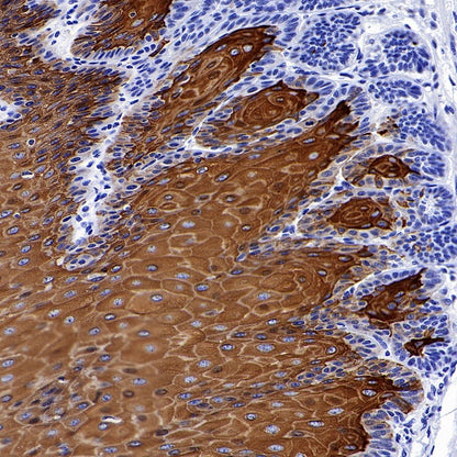 CK-13 Recombinant Rabbit mAb (SDT-R282)