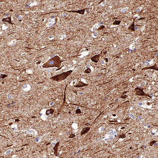 SERCA2 ATPase Recombinant Rabbit mAb (S-5956)