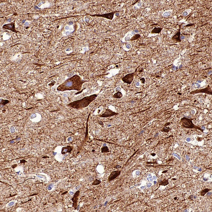 SERCA2 ATPase Recombinant Rabbit mAb (S-5956)