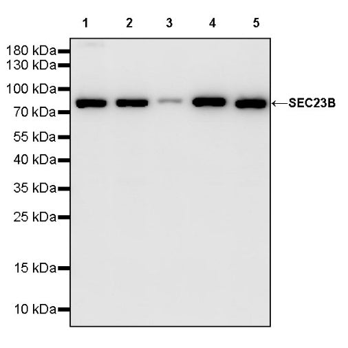 SEC23B Recombinant Rabbit mAb (S-1935-28)