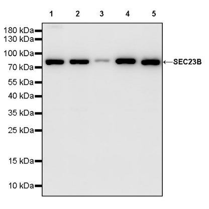 SEC23B Recombinant Rabbit mAb (S-1935-28)