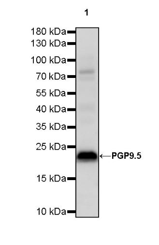 PGP9.5 Recombinant Rabbit mAb (SDT-665-37)