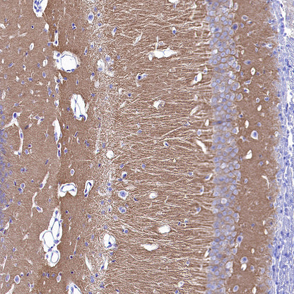 GRIA2 Recombinant Rabbit mAb (S-3446-123)