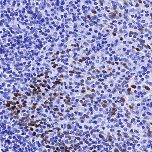p63 Recombinant Rabbit mAb (SDT-054-137)