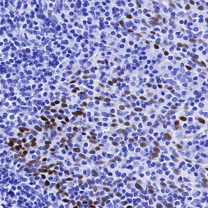 p63 Recombinant Rabbit mAb (SDT-054-137)