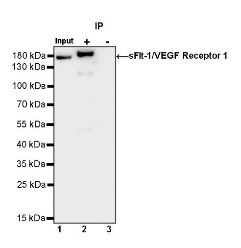 sFlt-1/VEGF Receptor 1 Recombinant Rabbit mAb (S-807-137)