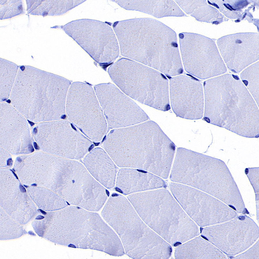GLUT3 + GLUT14 Recombinant Rabbit mAb (S-5945)