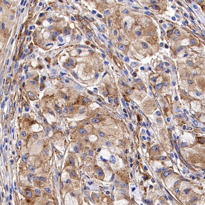 Paxillin Recombinant Rabbit mAb (S-619-12)