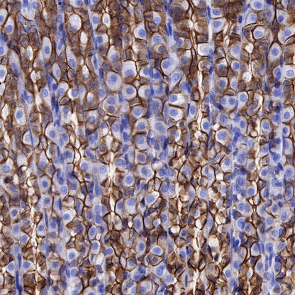 S-RMab® E-Cadherin Recombinant Rabbit mAb (SDT-438-5)