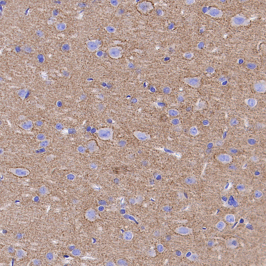 SV2A Recombinant Rabbit mAb (S-4049-16)