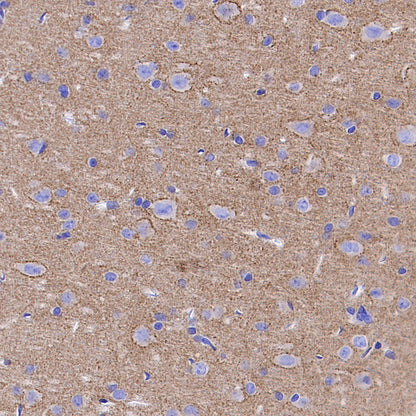 SV2A Recombinant Rabbit mAb (S-4049-16)