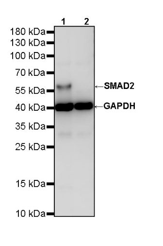 SMAD2 Recombinant Rabbit mAb (S-1521-177)